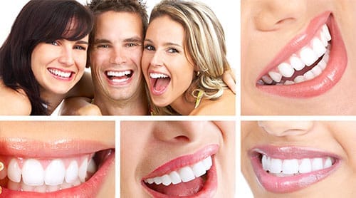 Smiling people with bright and white teeth